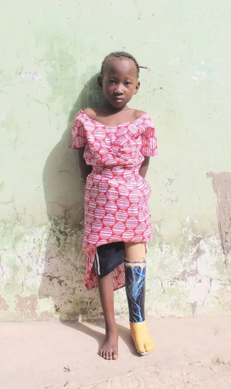 Legs4Africa: Giving new life to those in need