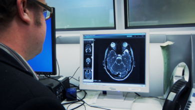 Brain Research: A leading national charity dedicated to funding world-class neurological research