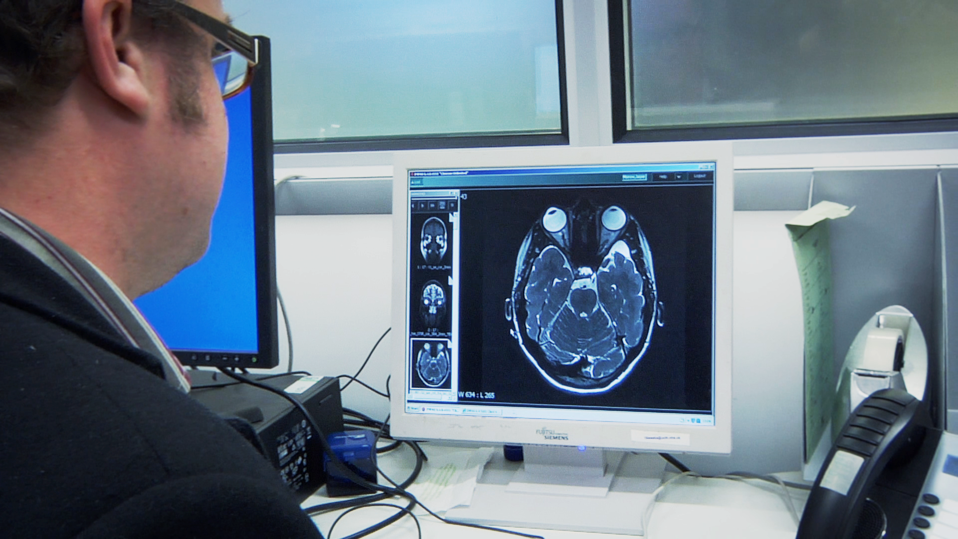 Brain Research: A leading national charity dedicated to funding world-class neurological research