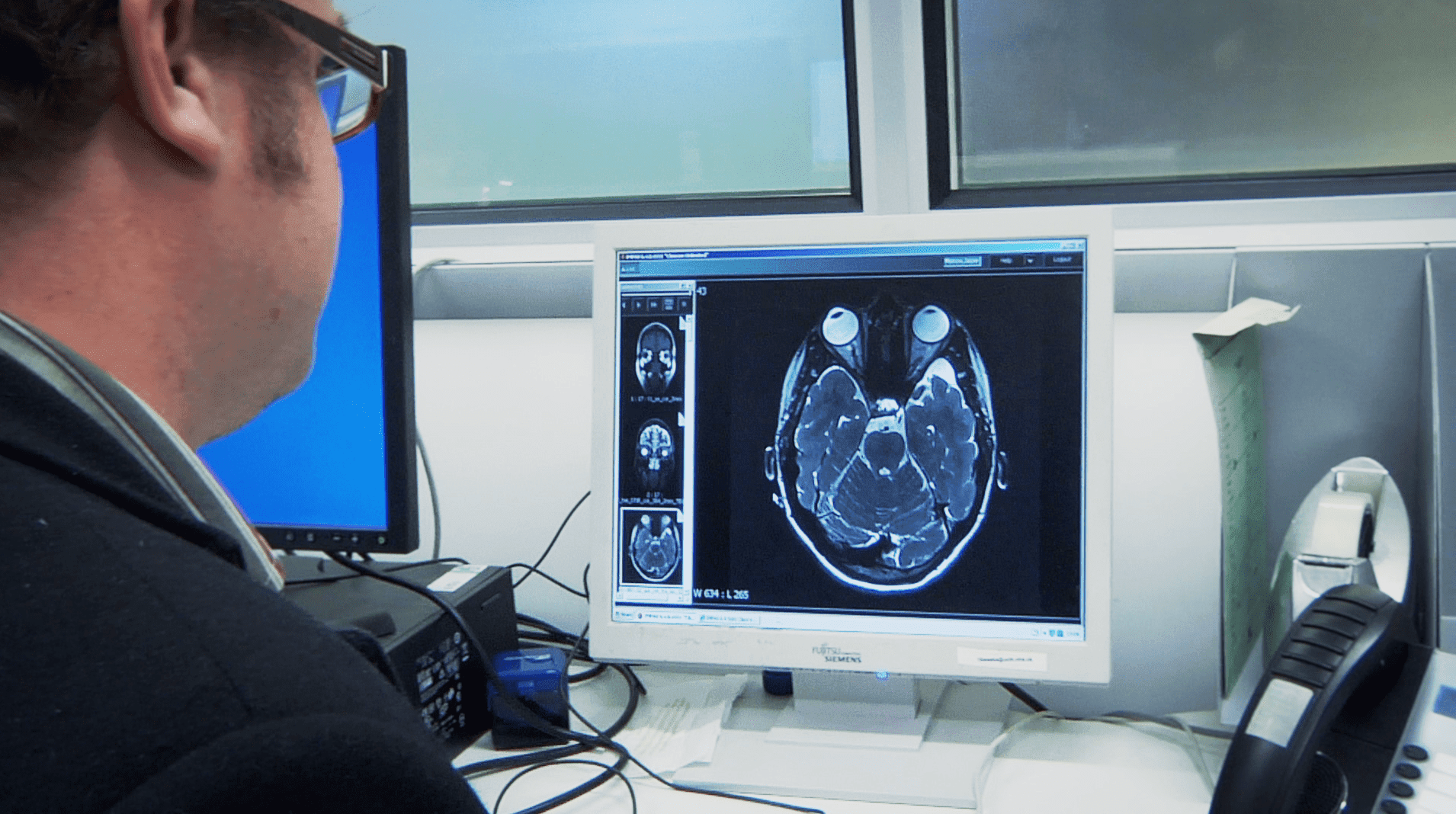 Brain Research UK is dedicated to funding world-class neurological research