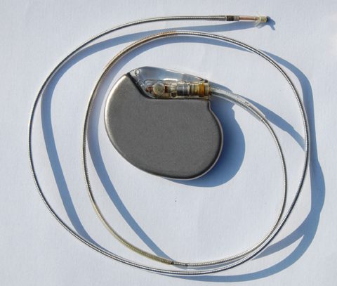 Kent funeral home to recycle pacemakers